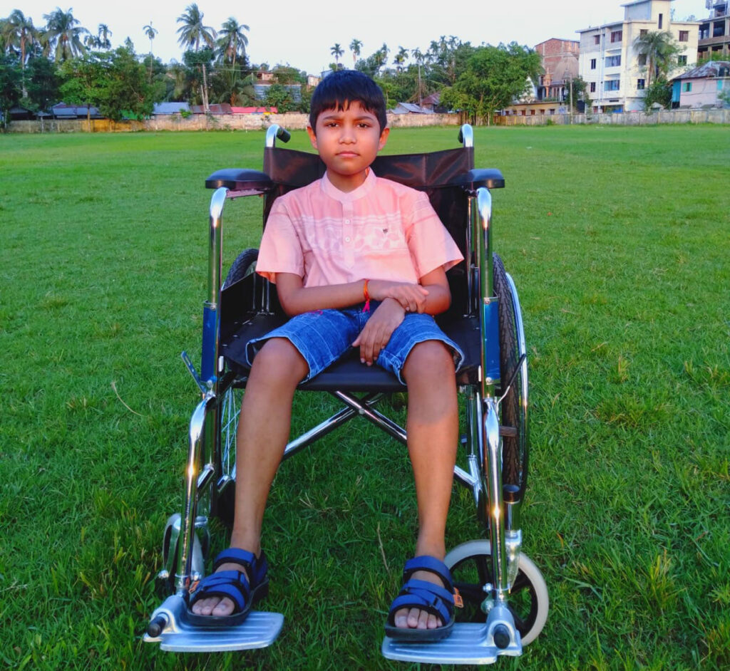 DMD Treatment